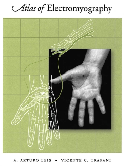Book Atlas of Electromyography free