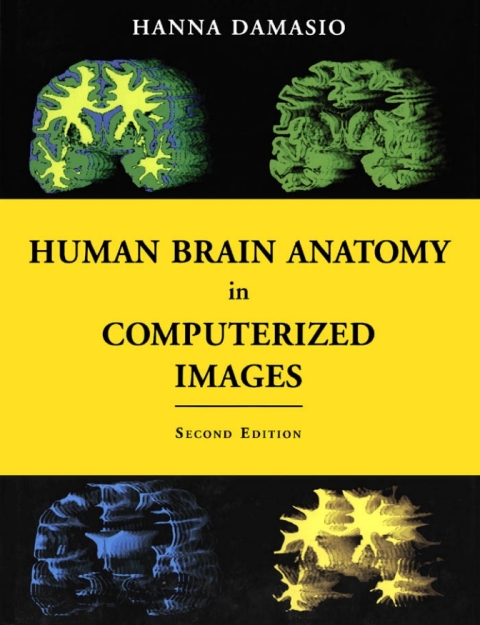 Book Human Brain Anatomy in Computerized Images free