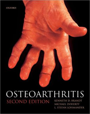 Book Osteoarthritis (Oxford Medical Publications) free