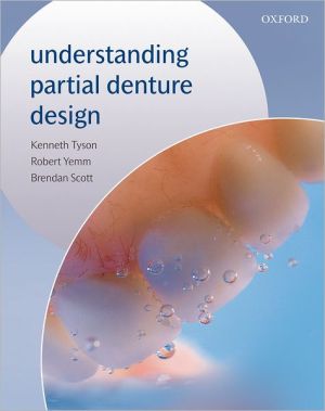 Book Understanding Partial Denture Design free