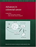 Book Advances in Colorectal Cancer (British Medical Bulletin) free