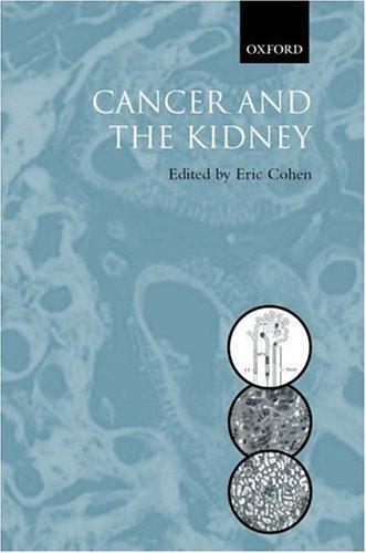 Book Cancer and the Kidney free