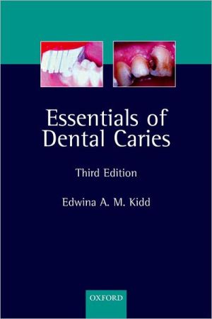 Book Essentials of Dental Caries: The Disease and Its Management free