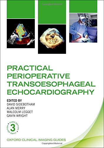 Book Practical Perioperative Transoesophageal Echocardiography (Oxford Clinical Imaging Guides, OCIG:P) free