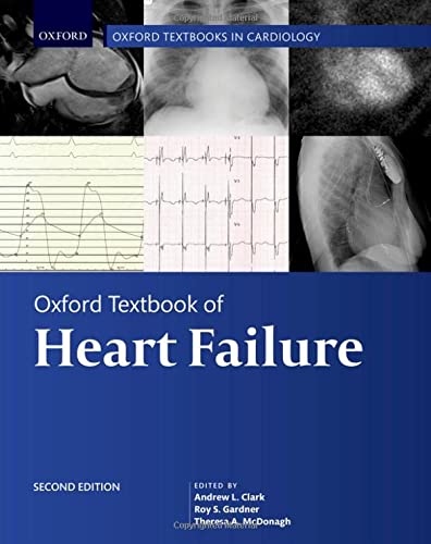 Book Oxford Textbook of Heart Failure (Oxford Textbooks in Cardiology) free