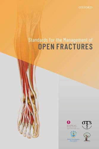 Book Standards for the Management of Open Fractures free