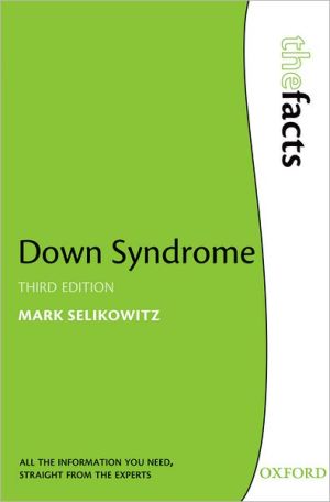 Book Down Syndrome (The Facts Series) free