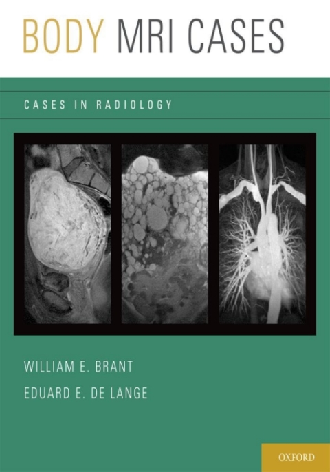 Book Body MRI Cases (Cases in Radiology) free