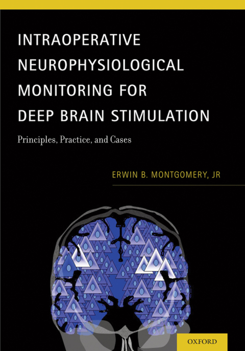 Book Intraoperative Neurophysiological Monitoring for Deep Brain Stimulation free
