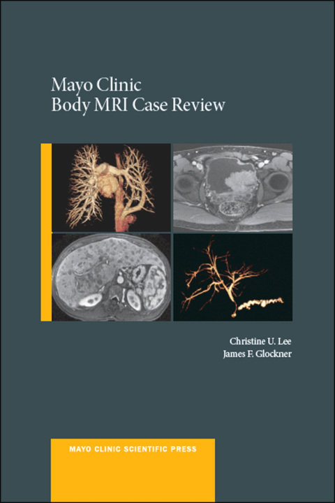 Book Mayo Clinic Body MRI Case Review (Mayo Clinic Scientific Press) free