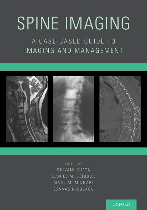 Book Spine Imaging: A Case-Based Guide to Imaging and Management free