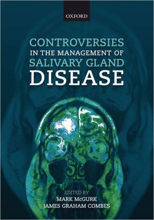 Book Controversies in the Management of Salivary Gland Disease free