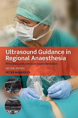 Book Ultrasound Guidance in Regional Anaesthesia: Principles and practical implementation free