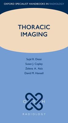 Book Thoracic Imaging (Oxford Specialist Handbooks in Radiology) free