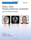 Book Challenging Concepts in Oral and Maxillofacial Surgery: Cases with Expert Commentary free
