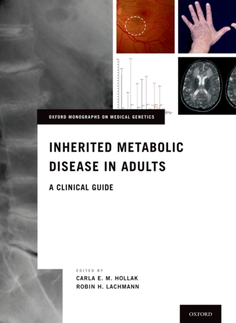 Book Inherited Metabolic Disease in Adults free