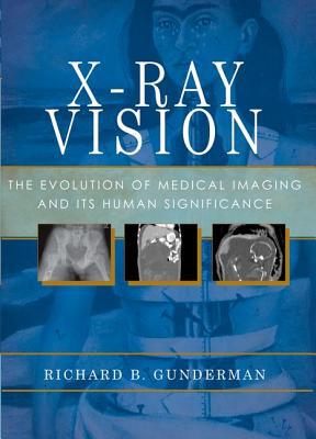 Book X-Ray Vision: The Evolution of Medical Imaging and Its Human Significance free