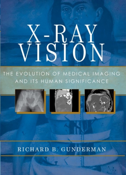Book X-Ray Vision free