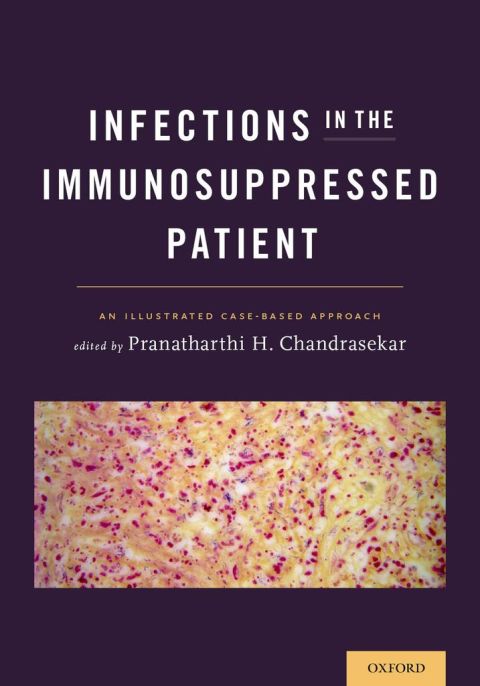Book Infections in the Immunosuppressed Patient: An Illustrated Case-Based Approach free