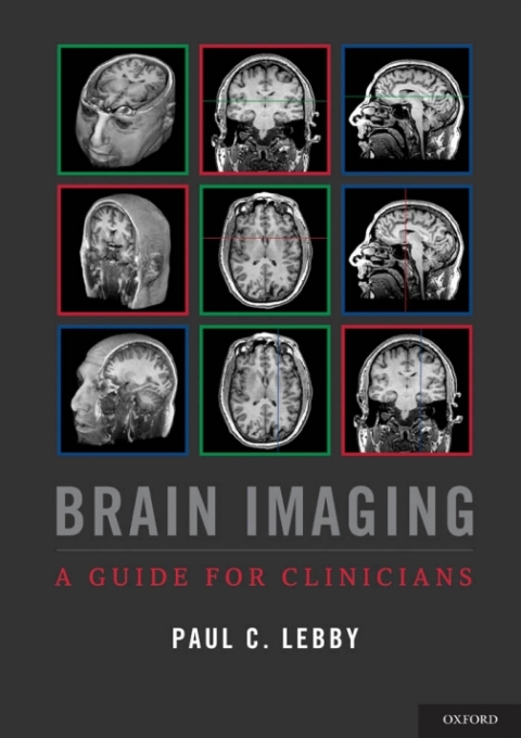 Book Brain Imaging free