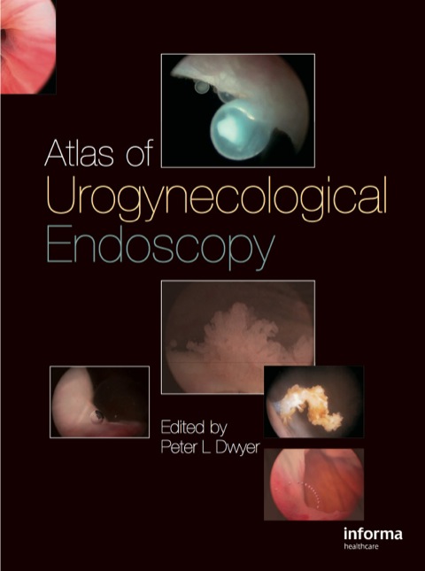 Book Atlas of Urogynecological Endoscopy free