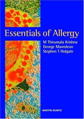 Book Essentials of Allergy free