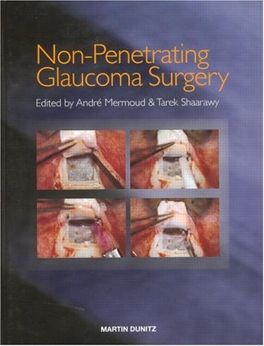 Book Non-Penetrating Glaucoma Surgery free