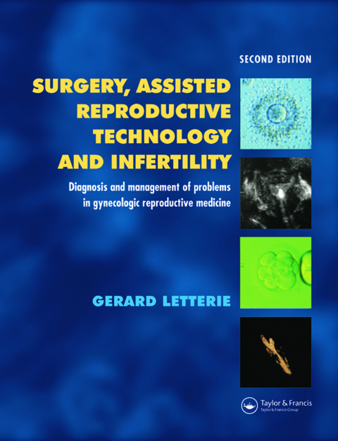 Book Surgery, Assisted Reproductive Technology and Infertility: Diagnosis and Management of Problems in Gynecologic Reproductive Medicine free