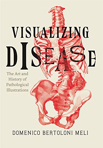 Book Visualizing Disease: The Art and History of Pathological Illustrations free