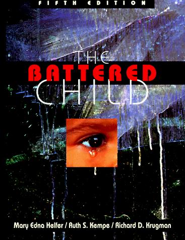 Book The Battered Child free