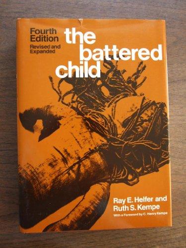 Book The Battered Child free