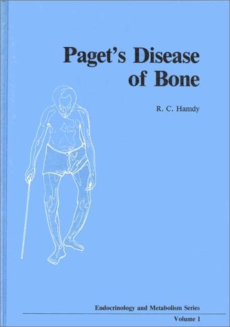 Book Paget's Disease of the Bone: Assessment and Management free