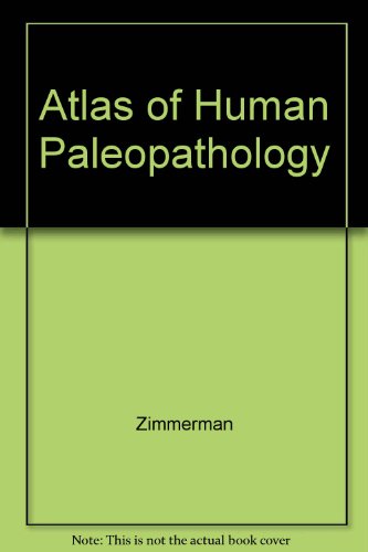 Book Atlas Of Human Paleopathology. free