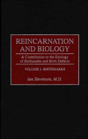 Book Reincarnation and Biology: A Contribution to the Etiology of Birthmarks and Birth Defects Volume 1: Birthmarks free