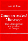 Book Computer-Assisted Microscopy: The Measurement and Analysis of Images free