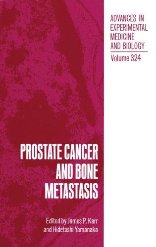 Book Prostate Cancer and Bone Metastasis (Environmental Science Research) free