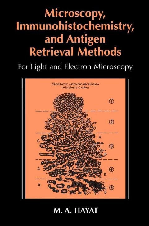 Book Microscopy, Immunohistochemistry, and Antigen Retrieval Methods free