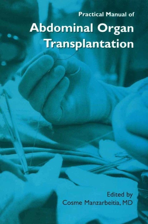 Book Practical Manual of Abdominal Organ Transplantation free
