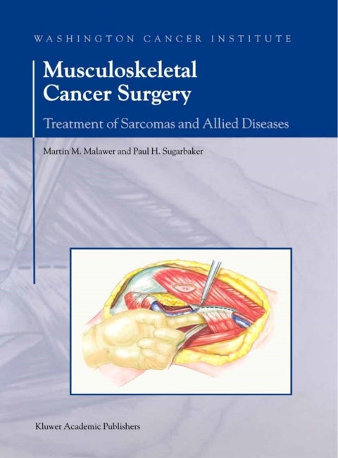 Book Musculoskeletal Cancer Surgery free